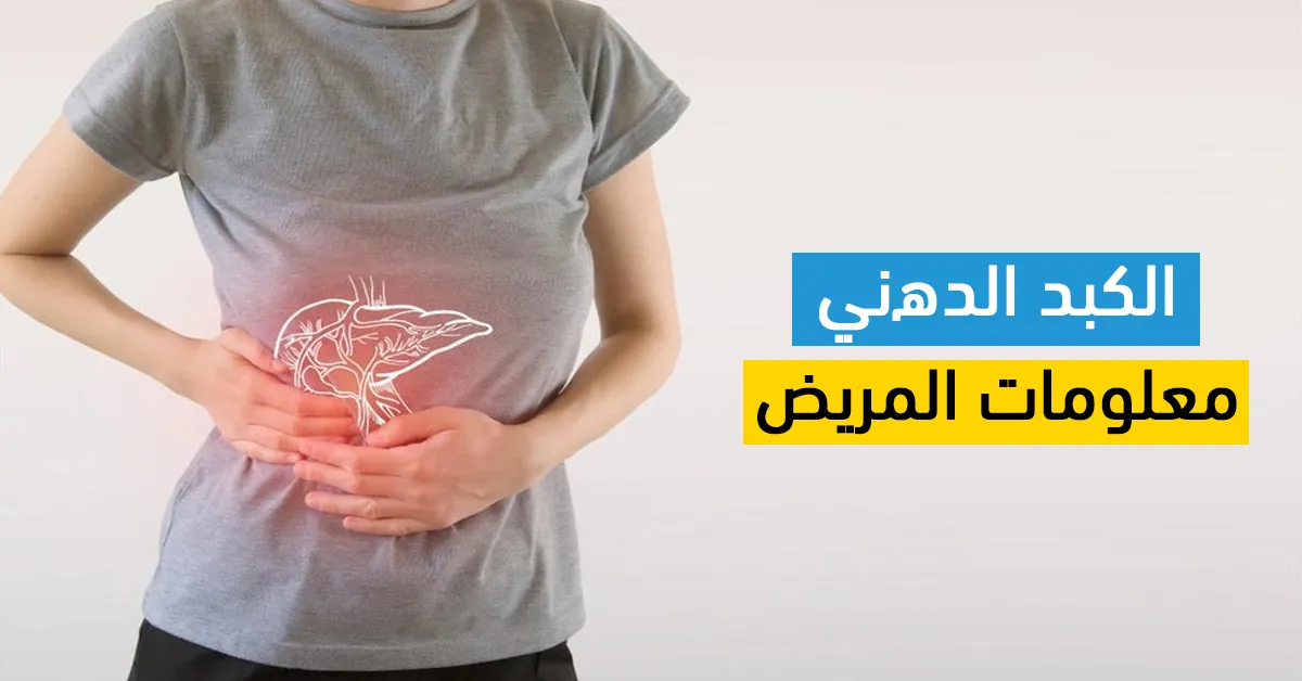 الكبد الدھني معلومات المریض